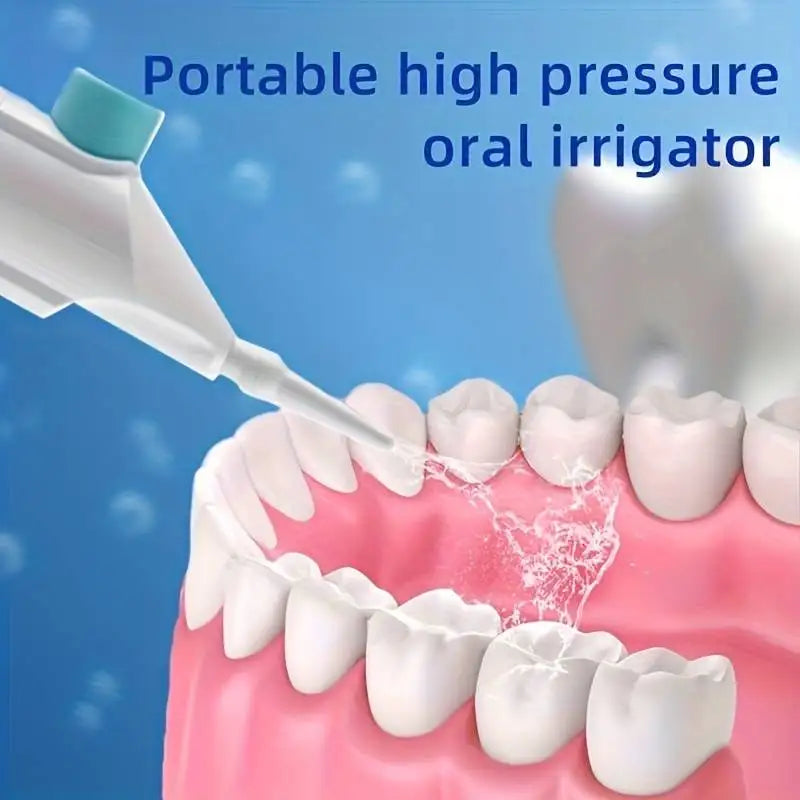 Portable High-Pressure Manual Oral Irrigator (Water Flosser)